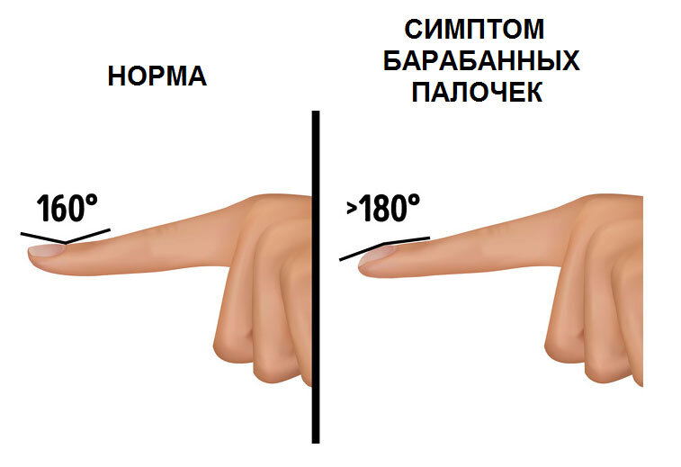 Президентмед | Лечение негрибковых болезней ногтей в Москве. Цены. Отзывы. Фото.