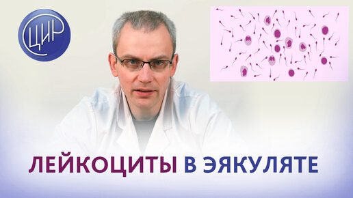 Лейкоциты в сперме | Полезное от клиники «Геном» в Калининграде