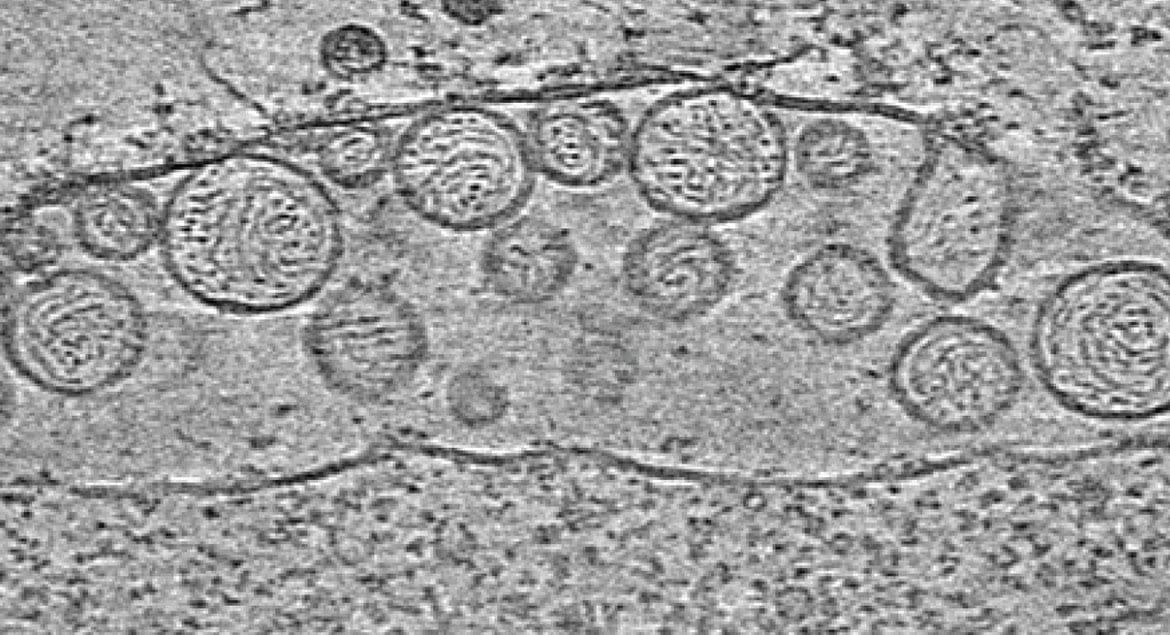 Криоэлектронная микроскопия митохондрии, содержащей РНК-вирионы. Иллюстрация: morgridge.org.