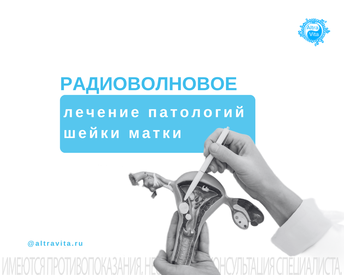 Радиоволновое лечение патологий шейки матки
