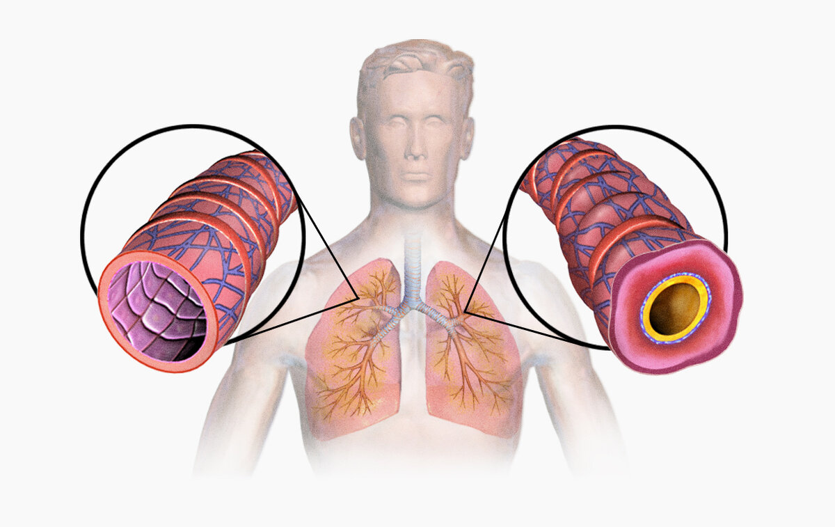   BruceBlaus / Wikimedia Commons / CC BY-SA 4.0