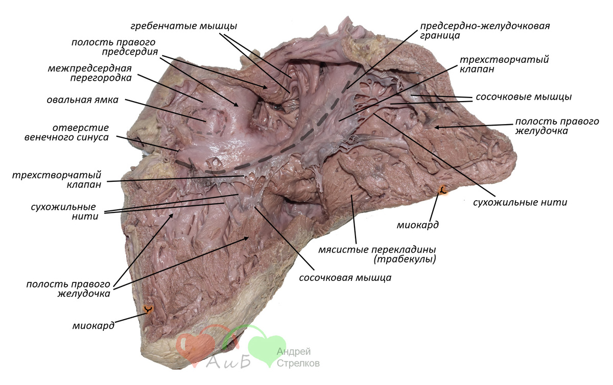Рис. 2. Внутреннее строение правого желудочка