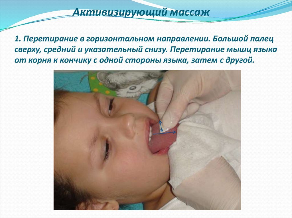 Зондовый логопедический массаж языка. Схема логопедического массажа при дизартрии. Зондовый логопедический массаж. Логопедический зондовый массаж для детей. Логопедический массаж для детей.