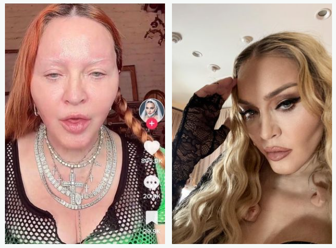 Поклонники обеспокоены тем, что на снимке слева Мадонна выглядит странно и болезненно. Они привыкли ее видеть такой, как на снимке справа.