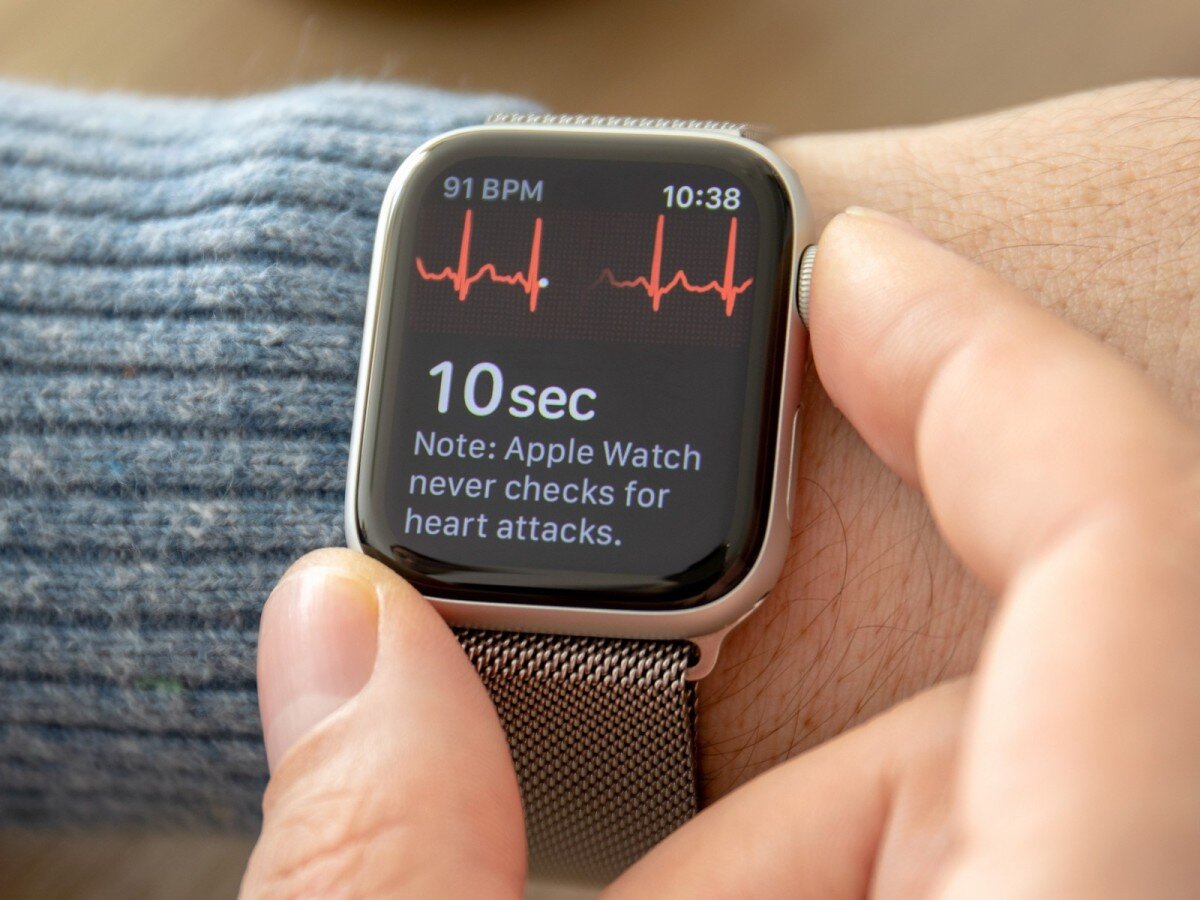    Медики высоко оценили возможность Apple Watch измерять ЭКГ