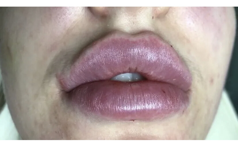 Техника тп увеличение губ. Губы тп брауде. Форма губ для увеличения. Губы тп брауде. Губы тп брауде.