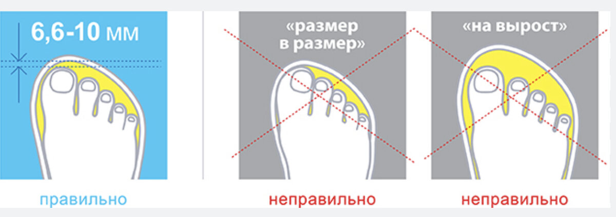 Запас обуви для ребенка. Правильный запас в детской обуви. Допустимый запас в детской обуви. Подобрать размер обуви ребенку.