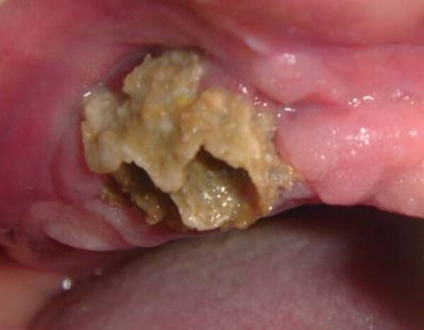 Фото из открытых источников (www.krasotaimedicina.ru)