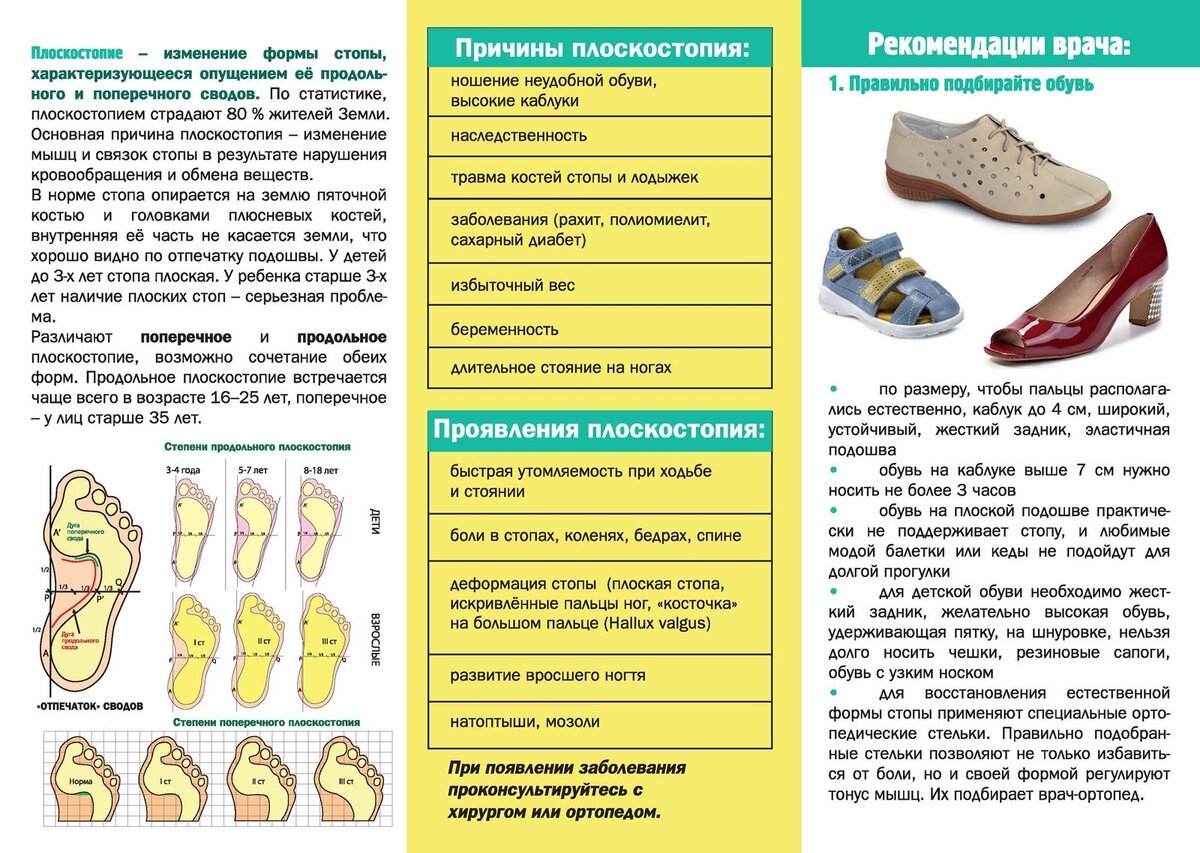 Профилактика плоскостопия у детей памятка