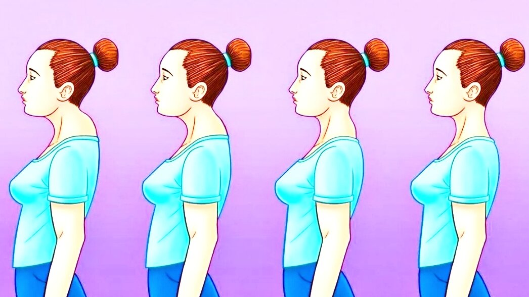 Холка бывает и у худеньких. Не только портит осанку, но и нарушает кровообращение 