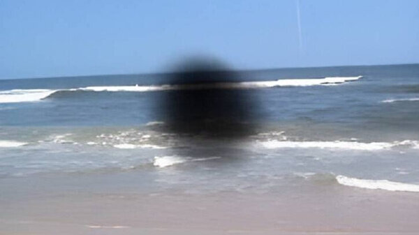 Центральная скотома. Изображение © Wikimedia Commons / Mick lucas