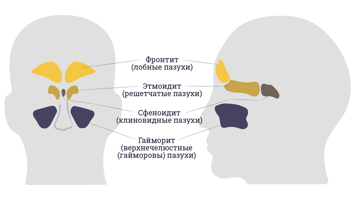 Берут ли в армию с гайморитом? | ПризываНет | Дзен