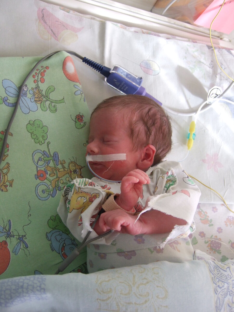 Возраст две недели.