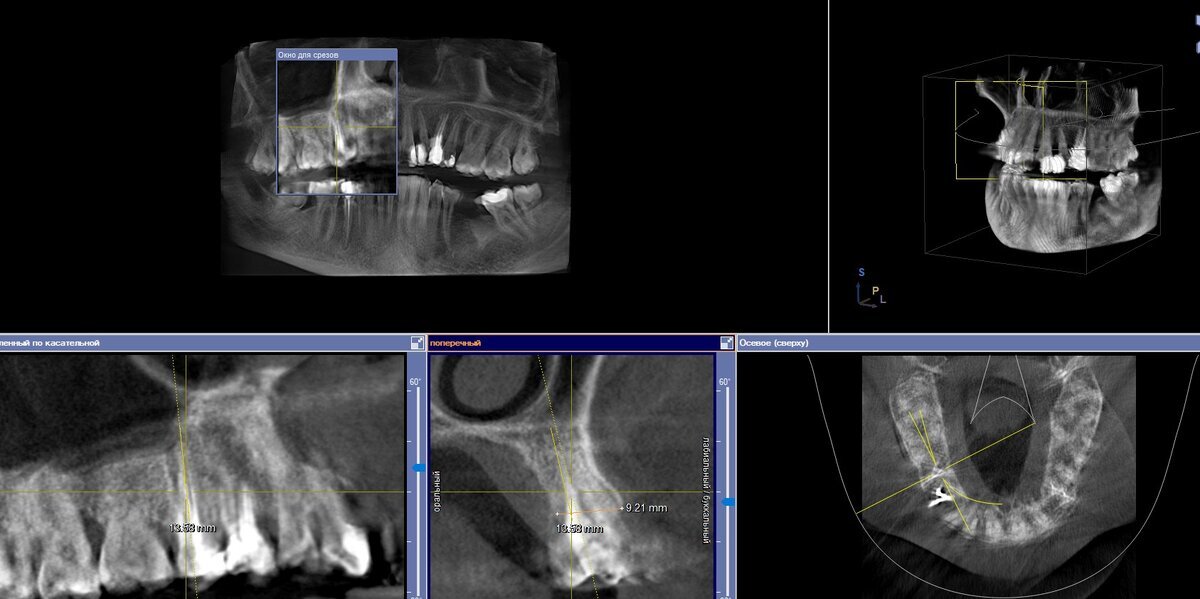 Добавьте описание