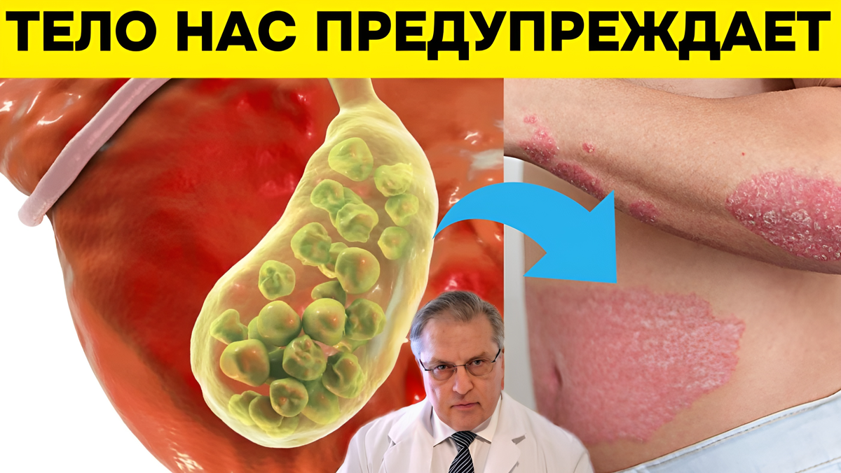 Недостаточность венозного кровообращения возможно при холецистите?