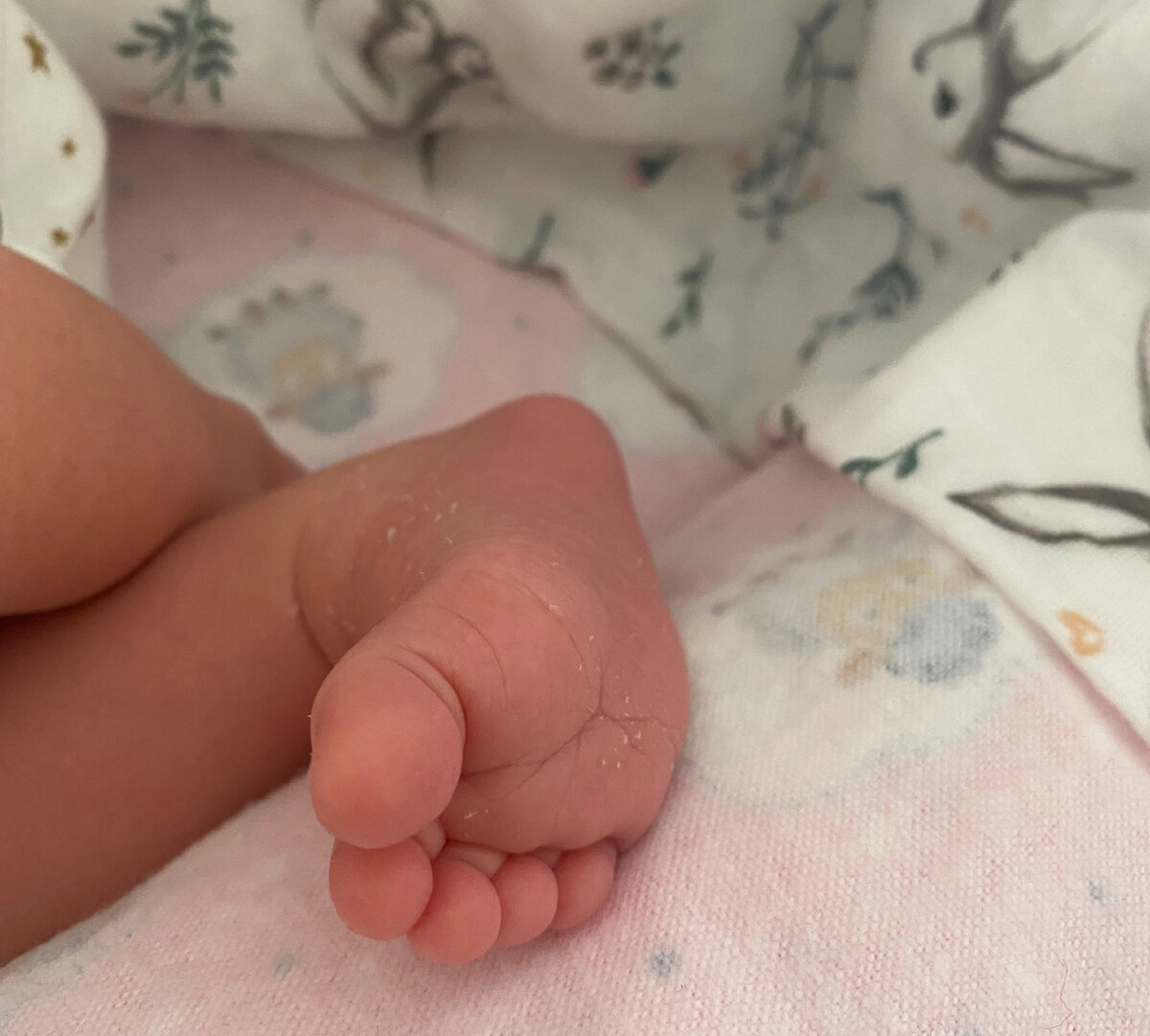 Первые дни после выписки. Дома.