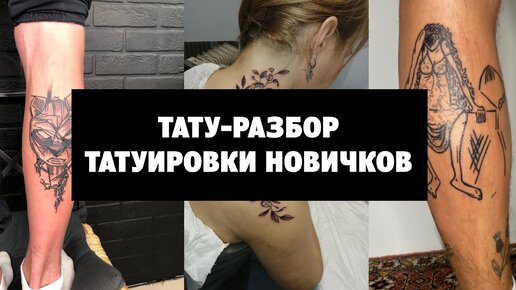 Удаление татуировок лазером