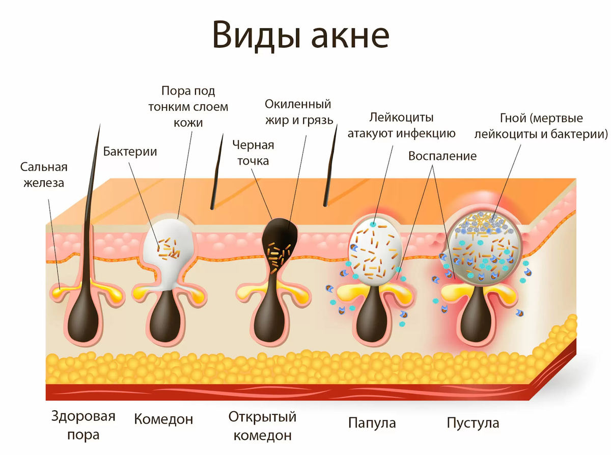 ТОП 3 заболеваний кожи: причины и лечение | Международный медицинский центр  «Синай» | Дзен