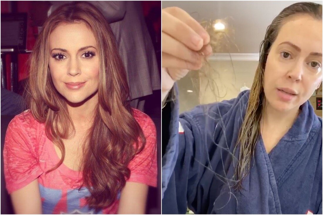 Почему выпадают волосы? | Научный подход к красоте | Дзен