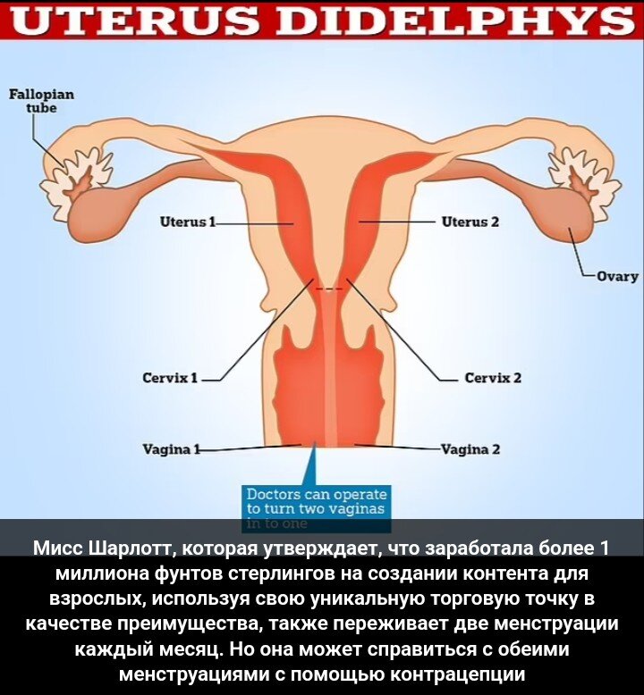 Операции: опущение матки и влагалища, выпадение матки, цена в СПб
