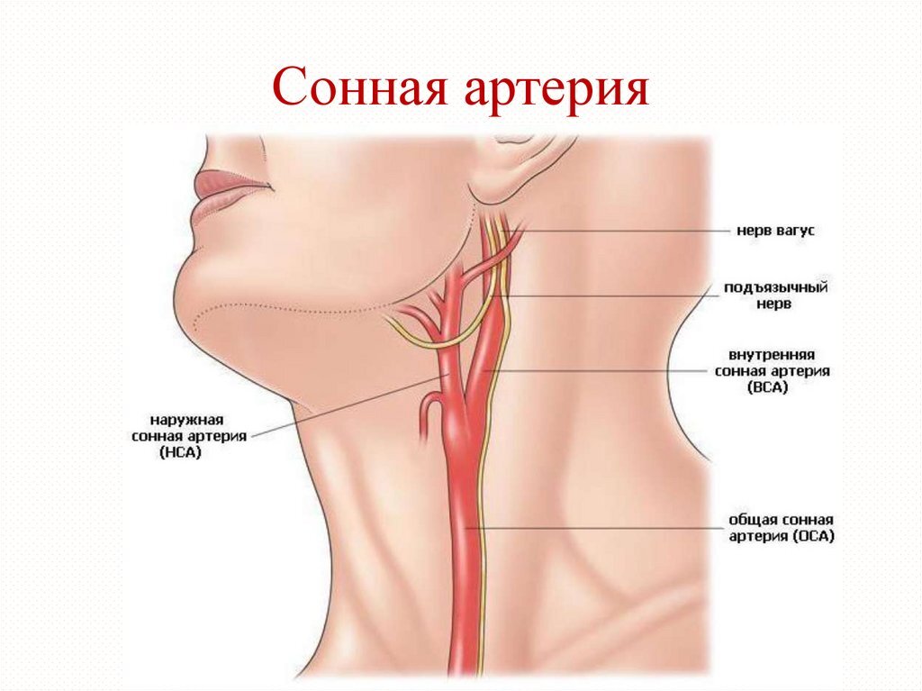 Так выглядит сонная артерия, не содержащая бляшек