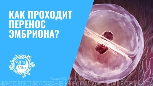 КАК ПРОХОДИТ ПЕРЕНОС ЭМБРИОНА #беременность #репродукция #переносэмбриона #эко