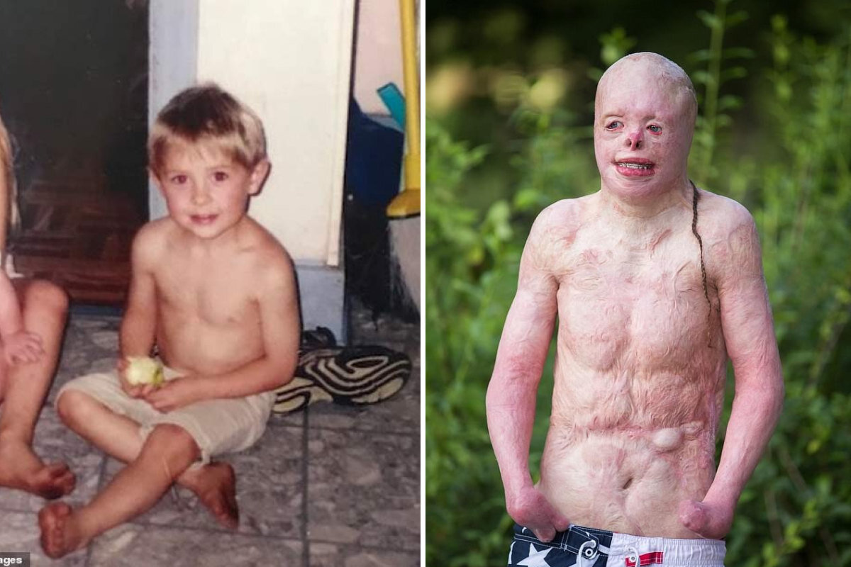 Джонни до пожара и сейчас. Источник Яндекс картинки.