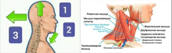 Профилактика обострений боли в спине