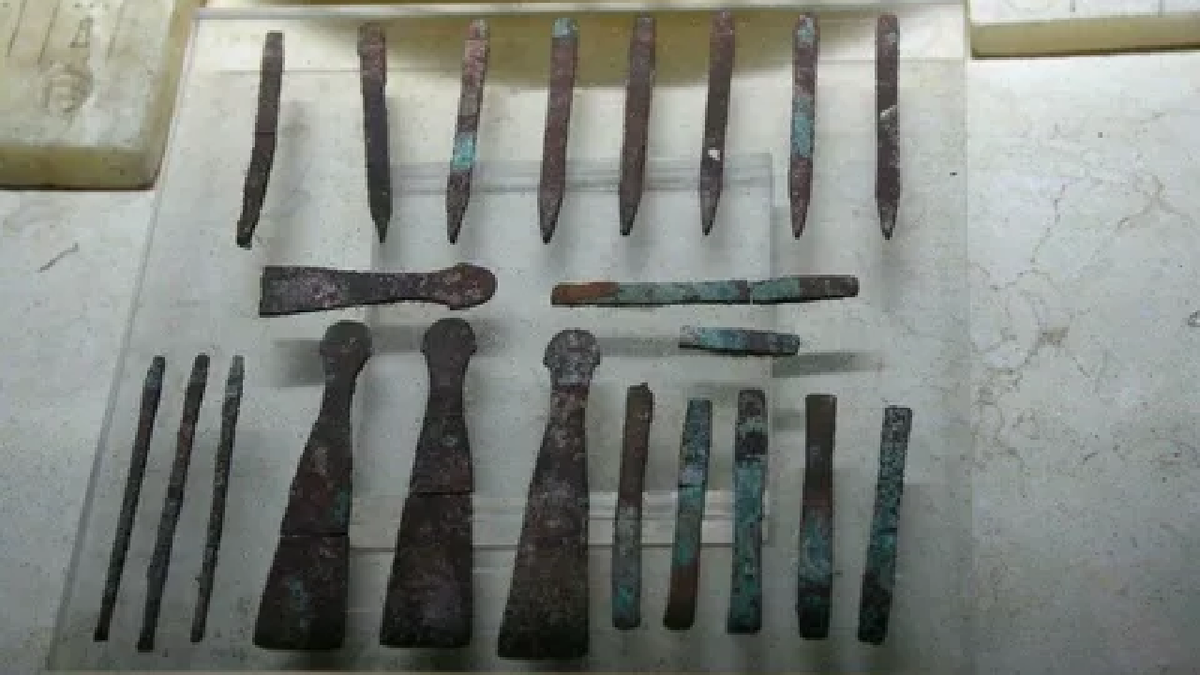 В древнем Египте врачи смело проводили самые сложные хирургические операции 