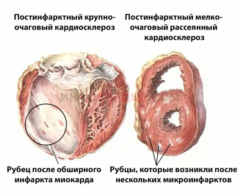 Ограничение доступа