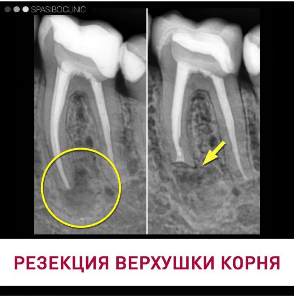 Ювелирная работа! НЕОБХОДИМА КОНСУЛЬТАЦИЯ СПЕЦИАЛИСТА 🤓 ⚙ Хирургия - Виталий Фуог     

