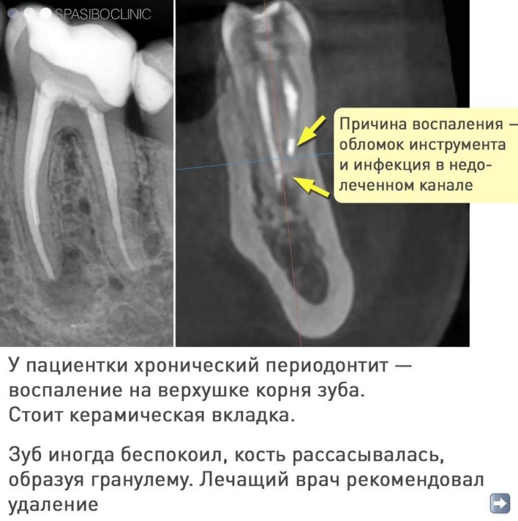 Ювелирная работа! НЕОБХОДИМА КОНСУЛЬТАЦИЯ СПЕЦИАЛИСТА 🤓 ⚙ Хирургия - Виталий Фуог     

-2