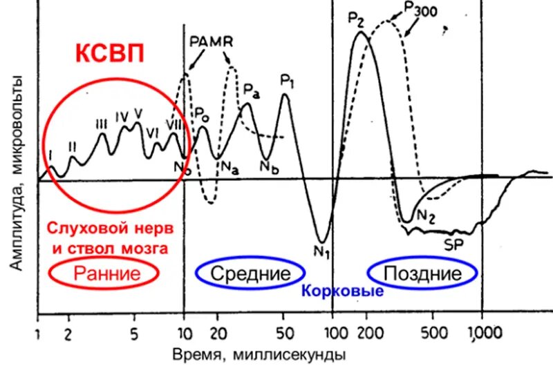 Расположение электродов: мастоид – вертекс – висок (нейтральный). Усреднение 1000 ответов. Адаптировано Ю. Соколовым из источника: Jon Shallop (1983). Electric Response Audiometry:  The Morphology of Normal Responses.