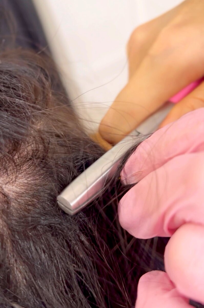 Необходимо использовать качественную жидкость для снятия волос