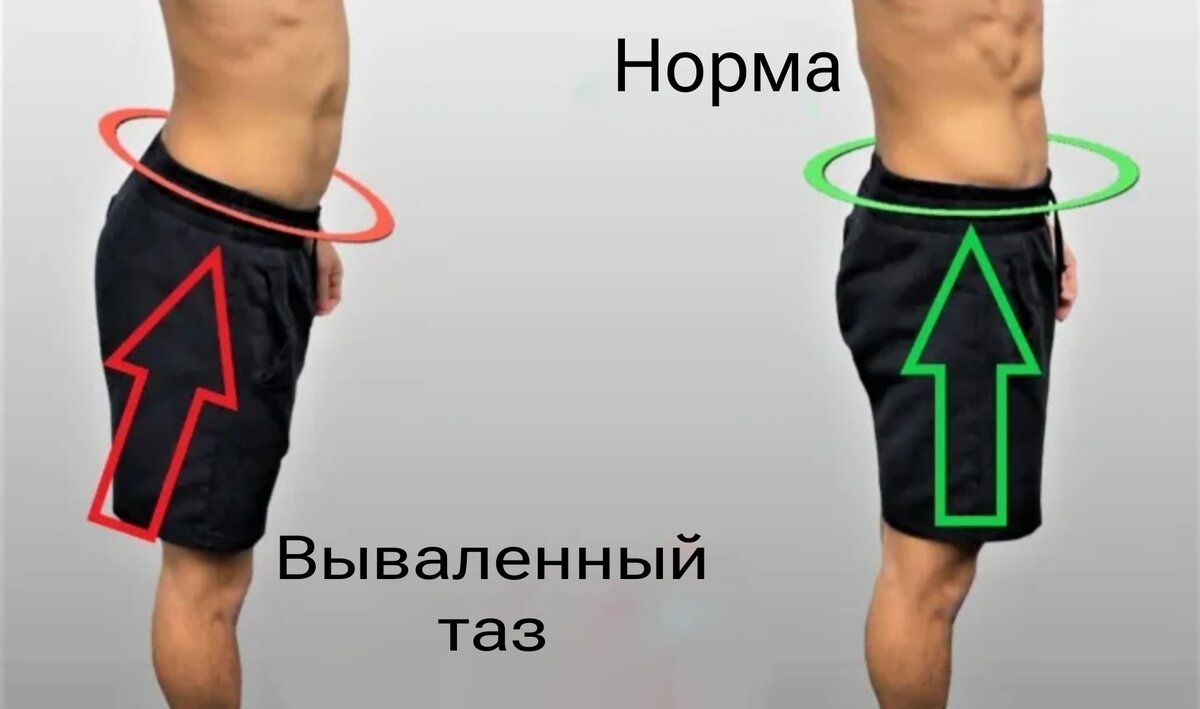 Но у мужчин тоже иногда бывает 