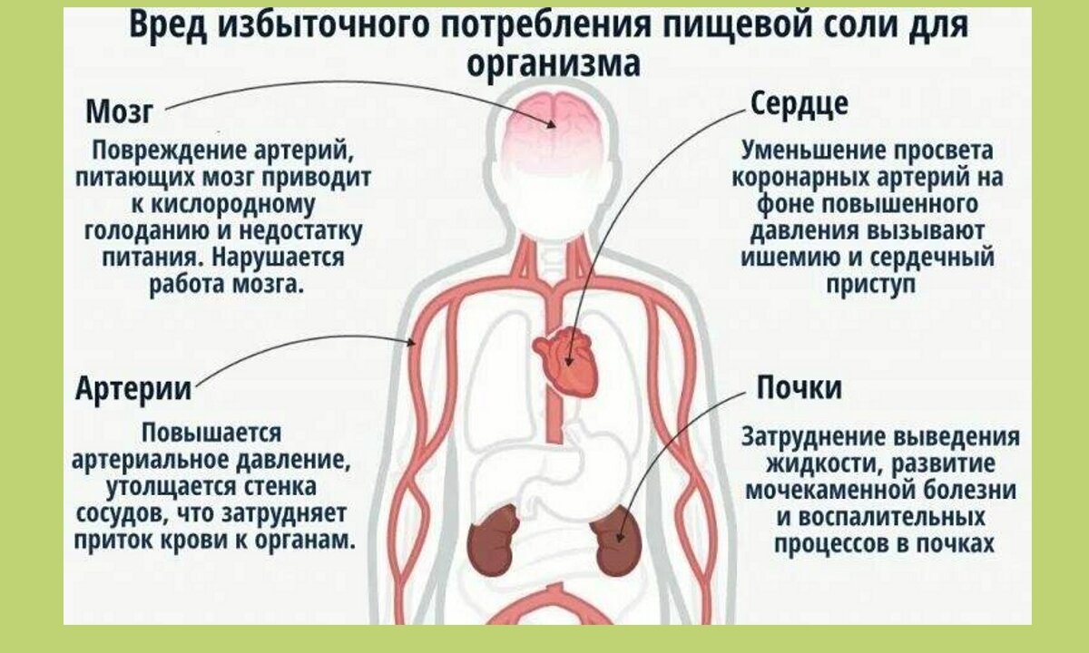 Возникнуть организм. Влияние соли на организм человека. Вред соли. Вред соли для организма. Избыток соли в организме человека.