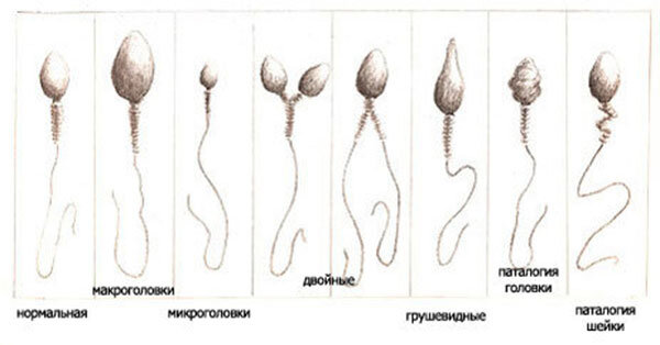 Короткая «жизнь» сперматозоидов