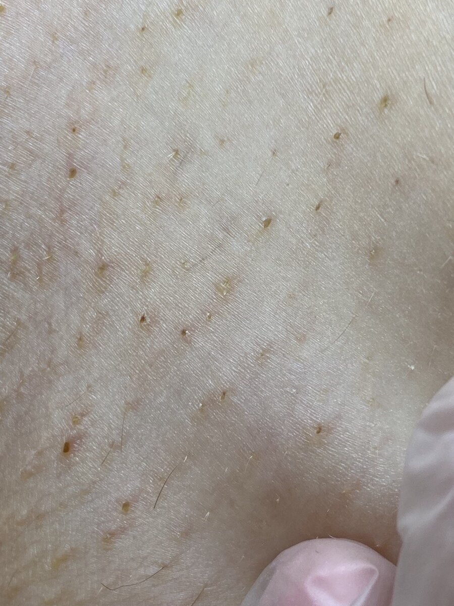 Допустимые корочки