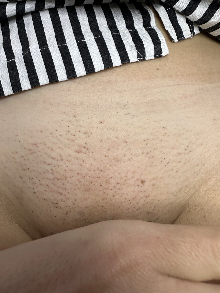 Допустимые, но лучше без них