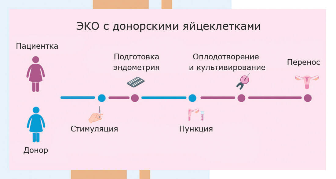 ЭКО с донорскими яйцеклетками