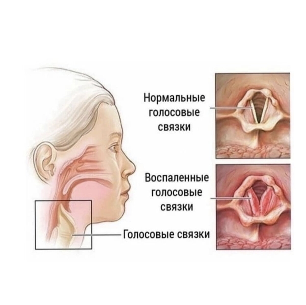 Про голос | Семья, еда, психология | Дзен