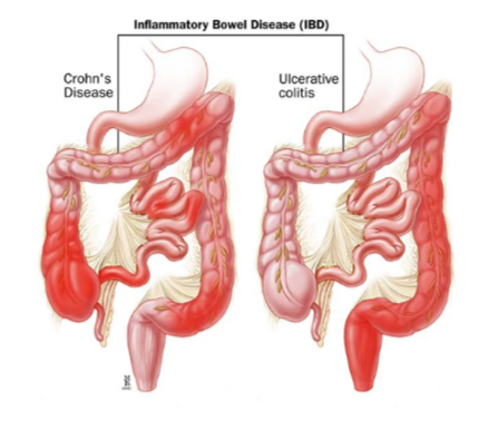Слева - БК, справа - ЯК. Не путайте