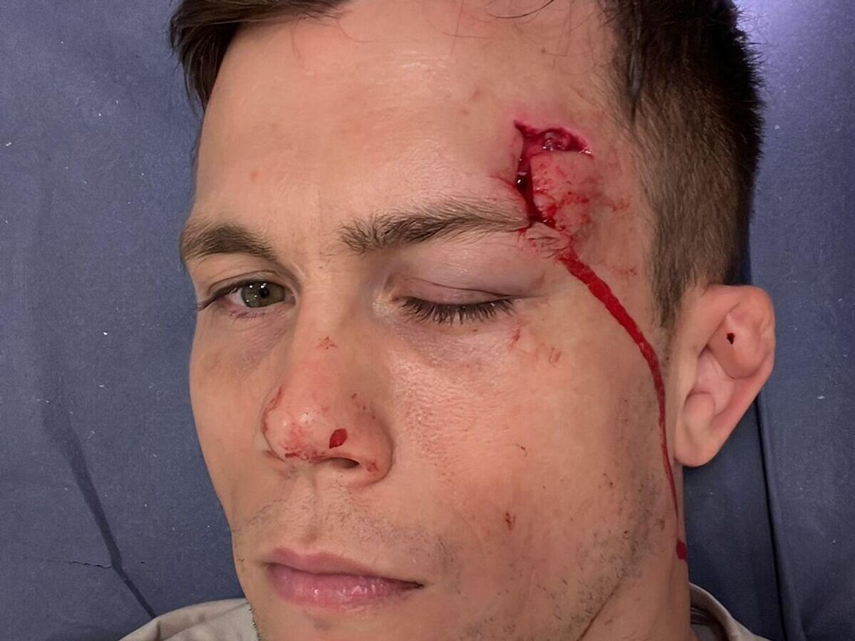    Даниэль Барез© Фото : Соцсети