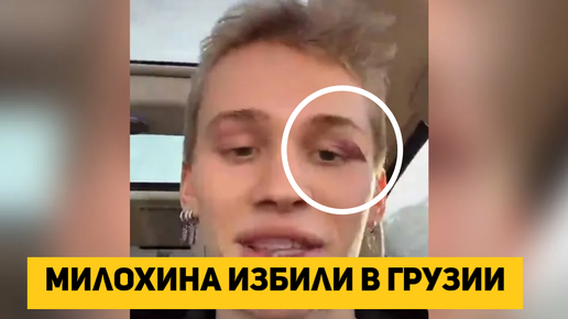 Милохина избили в Грузии | naran official | Дзен
