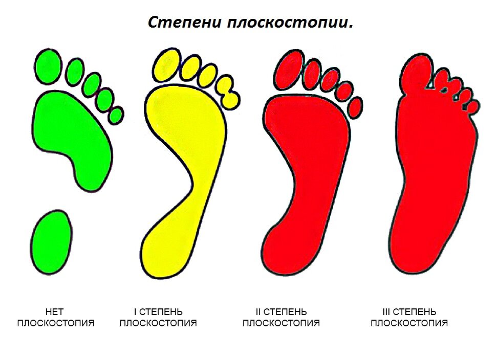 Помощь в получении белого военного билета - переходи по ссылке в телеграм:
https://t.me/+FtN50RJMzi41Y2Iy