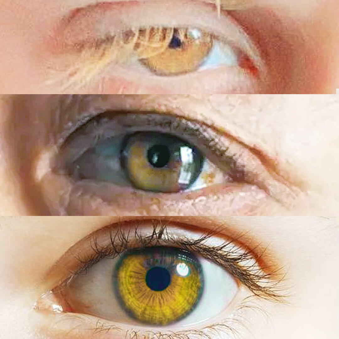 Глаза и люди: жёлтый цвет радужки