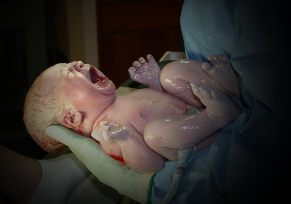 Когда младенец продвигается по родовым путям, грудная клетка сдавливается и жидкость вытесняется из легких. Таким образом в грудной клетке создается отрицательное давление и при рождении воздух всасывается в нее, выравнивая атмосферное давление. Потом воздух врывается в легкие, расправляет их подобно взрыву и сопровождается криком новорожденного.