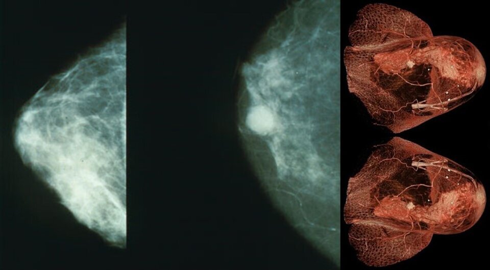   N + 1; Rsmskns / Wikimedia Commons / CC-BY-SA-4.0; Public Domain