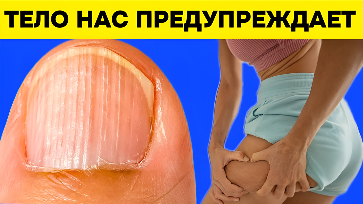 7 признаков дефицита белка и эффективные способы его устранения