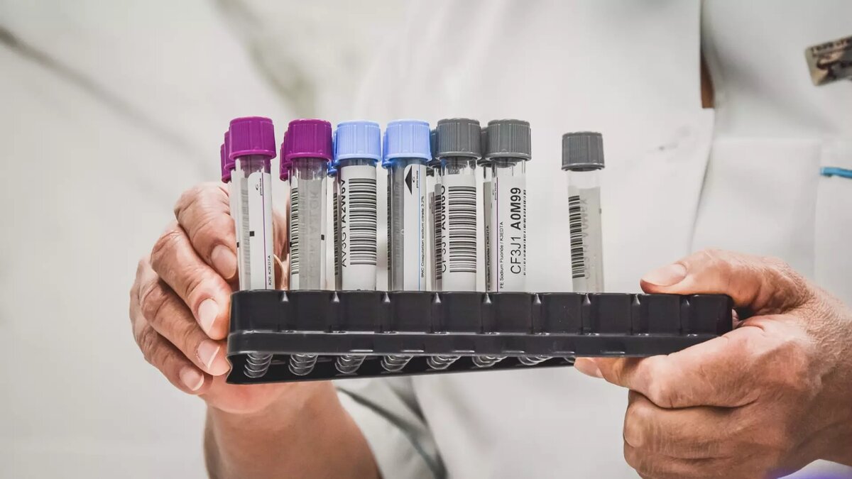     Режим ЧС вводится в связи с выявлением случаев узелкового дерматита у крупного рогатого скота, сообщила первый вице-премьер Удмуртии Ольга Абрамова на своей странице «ВКонтакте».